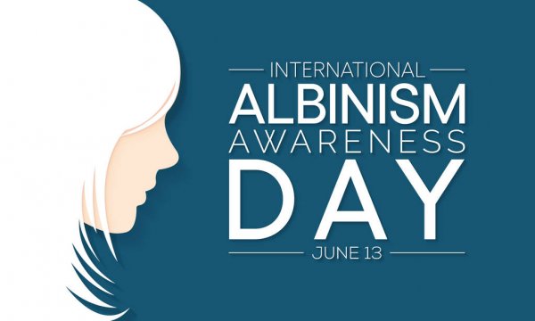 International Albinism Awareness Day