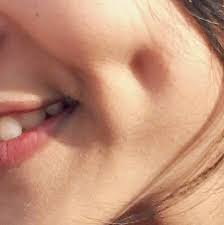 dimple on face meaning in hindi